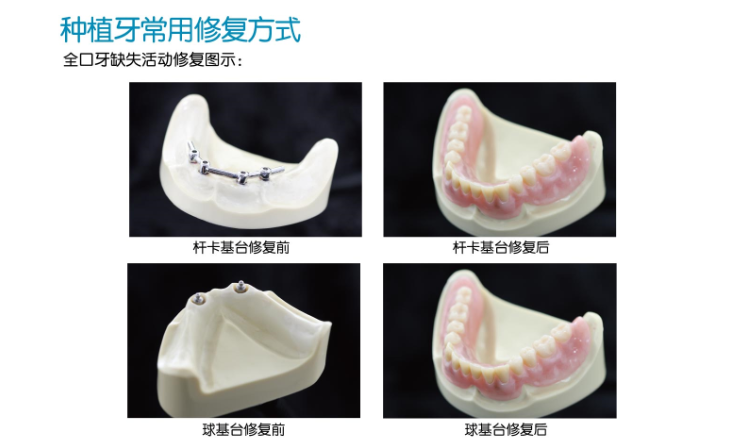 牙齒加工廠